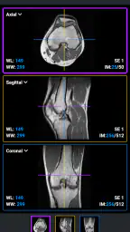 IDV - IMAIOS DICOM Viewer 5