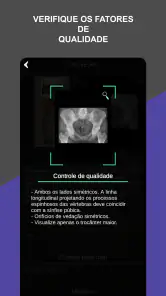 RX - Radiologia Posicionamento screenshot