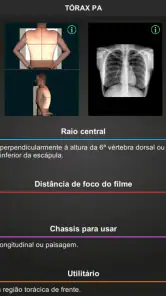 RX - Radiologia Posicionamento screenshot