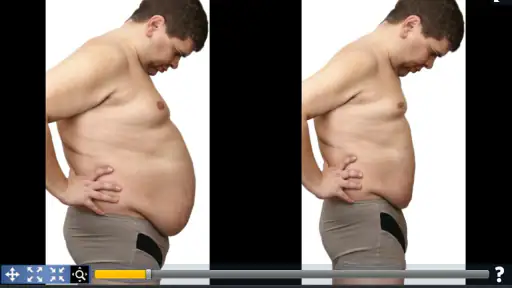 Simulador de Cirurgia Plástica 7