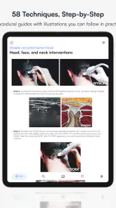 Ultrasound Pain screenshot