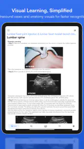 Ultrasound Pain screenshot