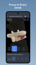 VOKA 3D Anatomi ve Patoloji 6