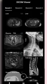 DICOM Viewer screenshot