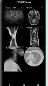 DICOM Viewer screenshot