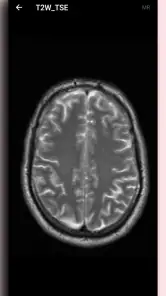 DICOM Viewer screenshot