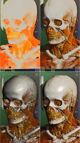 DroidRender - 3D DICOM viewer screenshot