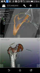 DroidRender - 3D DICOM viewer screenshot