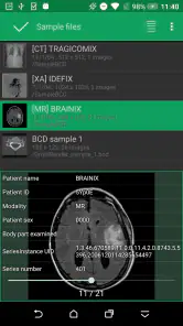 DroidRender - 3D DICOM viewer screenshot