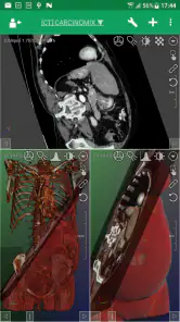 DroidRender - 3D DICOM viewer screenshot