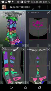DroidRender - 3D DICOM viewer screenshot