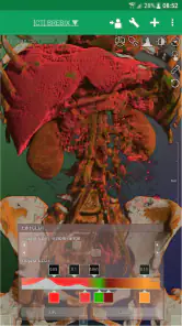 DroidRender - 3D DICOM viewer screenshot