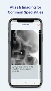 Medinfo: Medical information screenshot