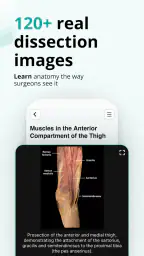 Teach Me Anatomy 4